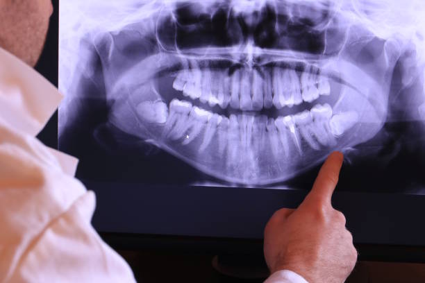 Best Emergency Dental Surgery in Ladonia, AL