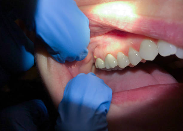 Best Emergency Treatment for Toothache in Ladonia, AL